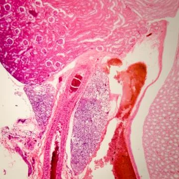 Microscopic section of human kidney tissue Stock Photos