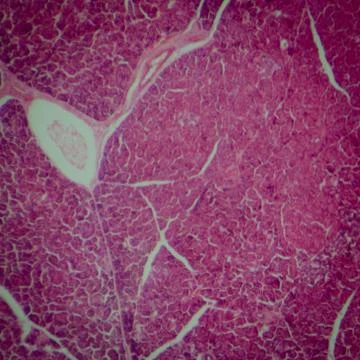 Microscopic section of human pancreas Foto stock