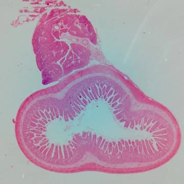 Microscopic section of human small intestinum tenue tissue Stock Photos