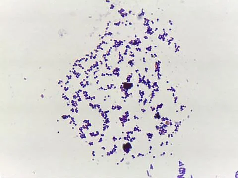 Microscopic Section of Lymphoid Tissue Showing Contrasting Follicle Zone Foto stock