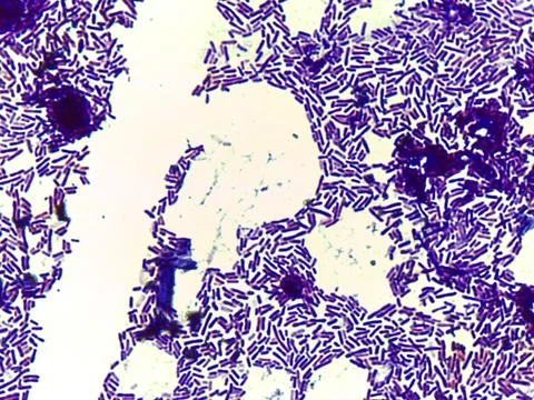 Microscopic Section of Lymphoid Tissue Showing Contrasting Follicle Zone 스톡 사진