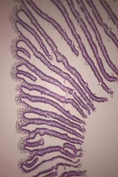 Microscopic section of purple-stained tissue with. 스톡 사진