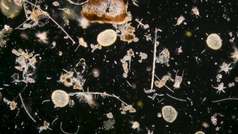 Microscopic shot of tiny bugs and insects moving around Stock Footage 220701205