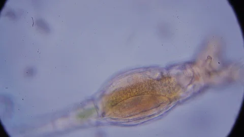 Microscopic Protozoa Stock Video Footage | Royalty Free Microscopic ...