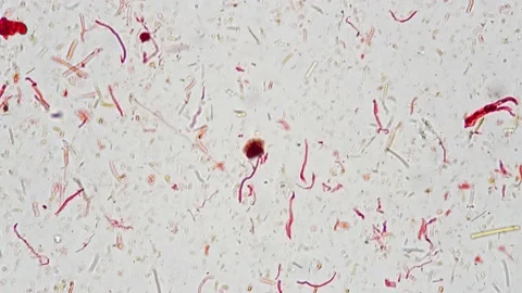 Microscopic slide with sperm smear 400x against bright field background Stock Footage 220035912