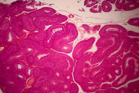 Microscopic stained section of tissue showing dense. 库存照片