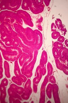Microscopic stained section of tissue showing dense. 写真素材