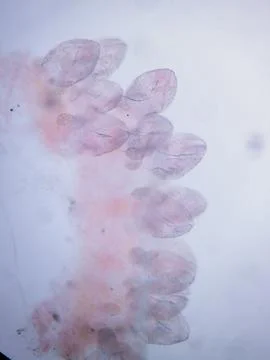 Microscopic stained tissue showing clustered parasitic hooks and attachment Photos