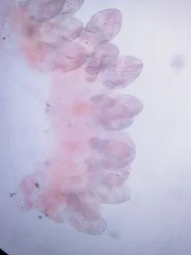 Microscopic stained tissue showing clustered parasitic hooks and attachment Photos