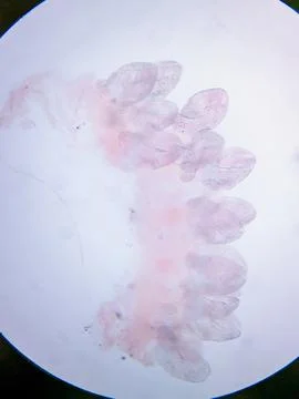Microscopic stained tissue showing clustered parasitic hooks and attachment Photos