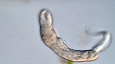 Microscopic Study of Fluke Cercariae Parasite Larvae Vídeos de archivo 317227285