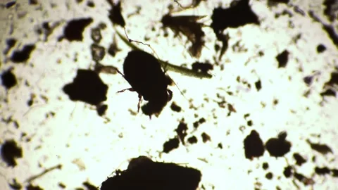 Microscopic tick moves and wiggle paws close-up in laboratory under a microscope Stock Footage 195552144