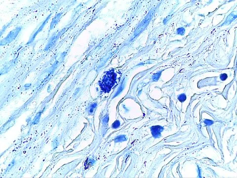 Microscopic Tissue Analysis with Blue Highlights 스톡 사진