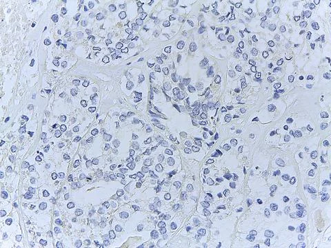 Microscopic Tissue Analysis with Blue Staining Foto stock