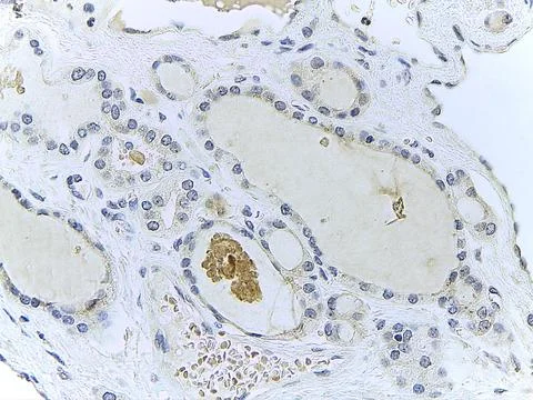 Microscopic Tissue Analysis 스톡 사진