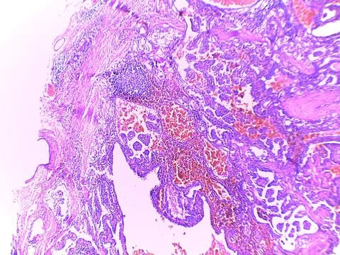 Microscopic Tissue Analysis 스톡 사진