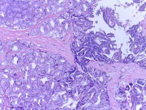 Microscopic Tissue Analysis with Purple Staining 스톡 사진