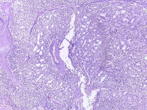 Microscopic Tissue Sample Analysis 스톡 사진