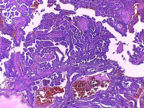 Microscopic Tissue Sample with Purple Staining 스톡 사진
