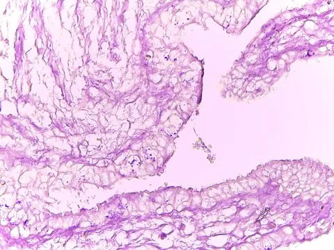Microscopic Tissue Staining in Purple 스톡 사진