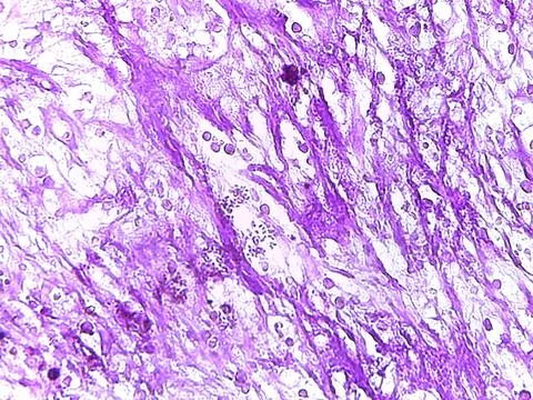 Microscopic Tissue Structure in Purple Stain Stock Photos
