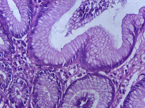 Microscopic Tissue Structure with Purple Staining Stock Photos