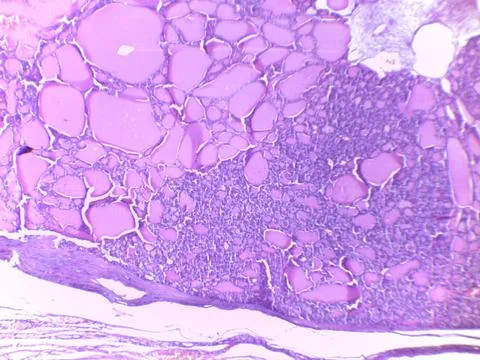 Microscopic View of Adipose Tissue Stock Photos