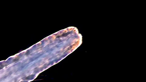 Microscopic View of Aquatic Worms Aeolosoma in Motion, darkfield microscopy 動画素材 317925525