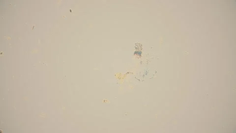 Microscopic View of Bacteria in Natural Sample Observed Through Lens Vídeos de archivo 341925973