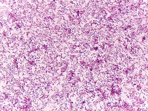 Microscopic view of bacteria 스톡 사진