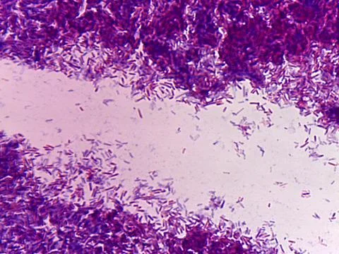 Microscopic view of bacteria in a sample 스톡 사진
