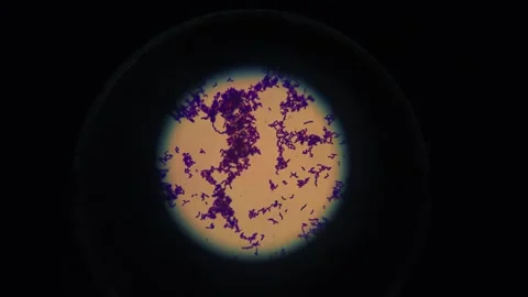 Microscopic View of Bacterial Cells Under Microscope in Laboratory Research Stock Footage 335897249