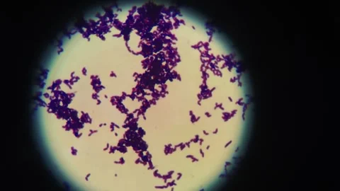 Microscopic View of Bacterial Cells Under Microscope in Laboratory Research 스톡 동영상 335897277