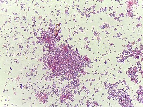 Microscopic view of bacterial colonies 스톡 사진