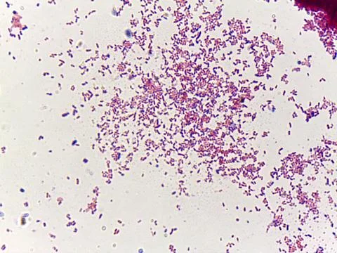 Microscopic view of bacterial colonies 스톡 사진