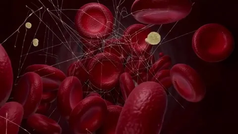 Microscopic view of blood coagulation and thrombosis in a vein Stock Footage 331860060