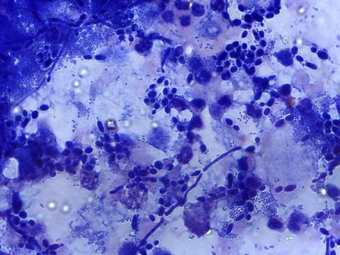 Microscopic View of Blue-Stained Cells and Microorganisms Stock Photos