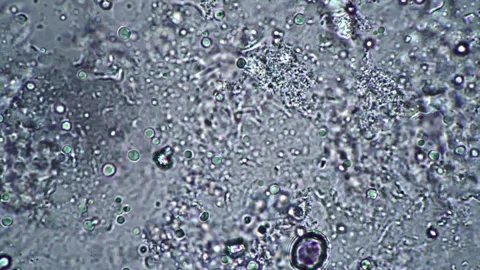 Microscopic View of Cellular Structures with Detailed Particles in Monochro.. Stock Footage 341925983