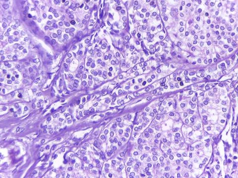 Microscopic View of Cellular Structures in Purple Stain 스톡 사진