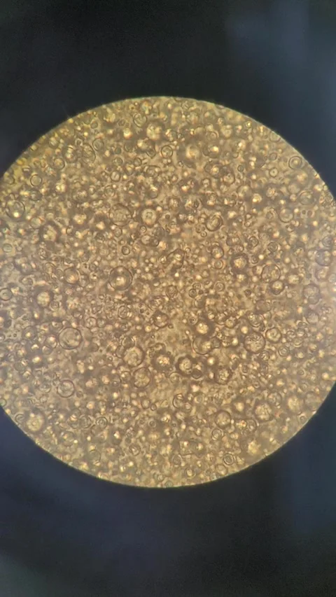 Microscopic view of cow breast milk showing lipid Vídeos de archivo 331446169