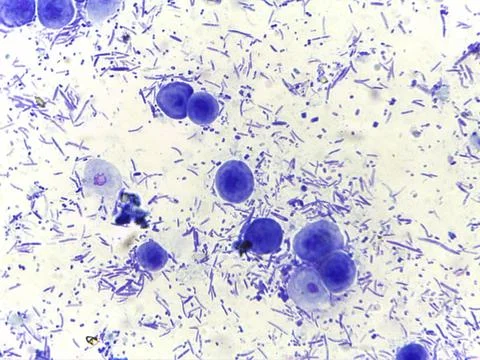 Microscopic View of Diverse Microorganisms 스톡 사진