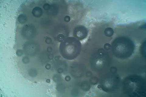 Microscopic view of dried yeast dissolved in water View through microscope... Stock Photos
