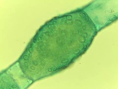Microscopic View of the Filamentous Green Algae, Pithophora, Showing Akinet 스톡 사진
