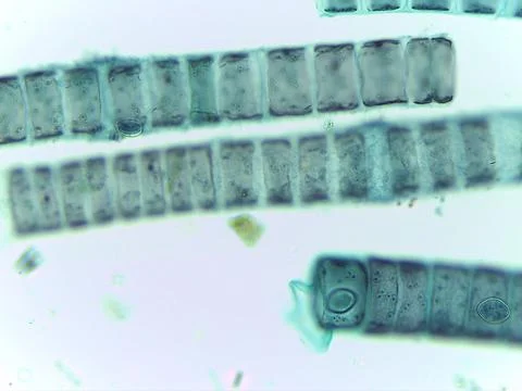Microscopic View of the Filamentous Green Algae Ulothrix 스톡 사진