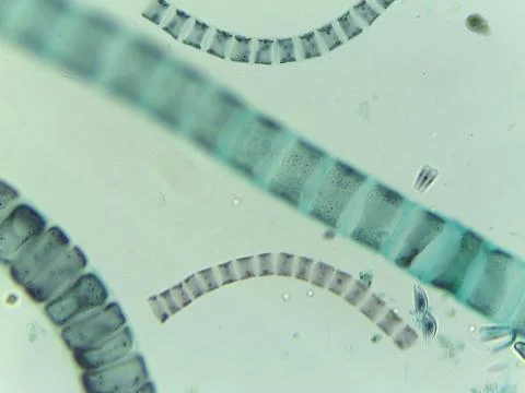 Microscopic View of the Filamentous Green Algae Ulothrix Stock Photos