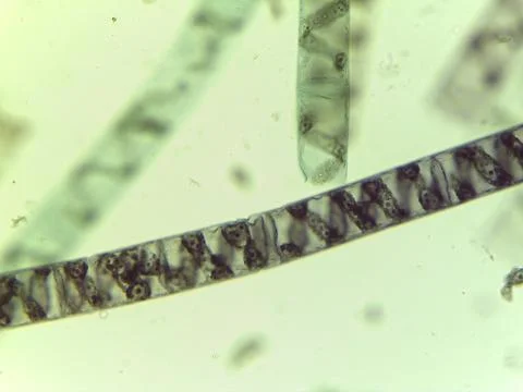 Microscopic View of the Filamentous Green Algae, Spirogyra, Highlighting Sp.. Foto stock