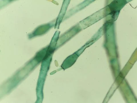 Microscopic View of the Filamentous Green Algae, Pithophora, Showing Akinet 写真素材