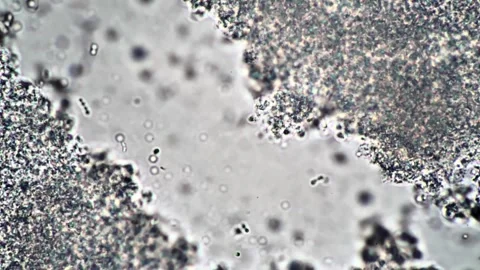 Microscopic View of Fluid and Particles with Granular Texture Captured Nearby Vídeos de archivo 341925920