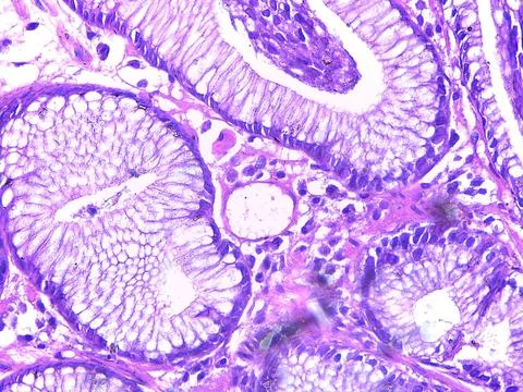 Microscopic View of Glandular Tissue 스톡 사진