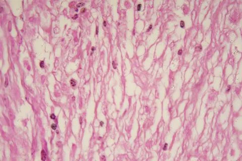 Microscopic view of Histoplasma capsulatum Stock Photos